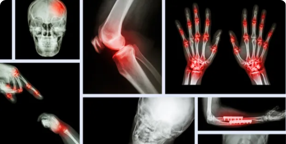 Classificação de Objetos Médicos