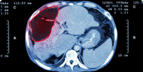 Deteção de Objetos Médicos